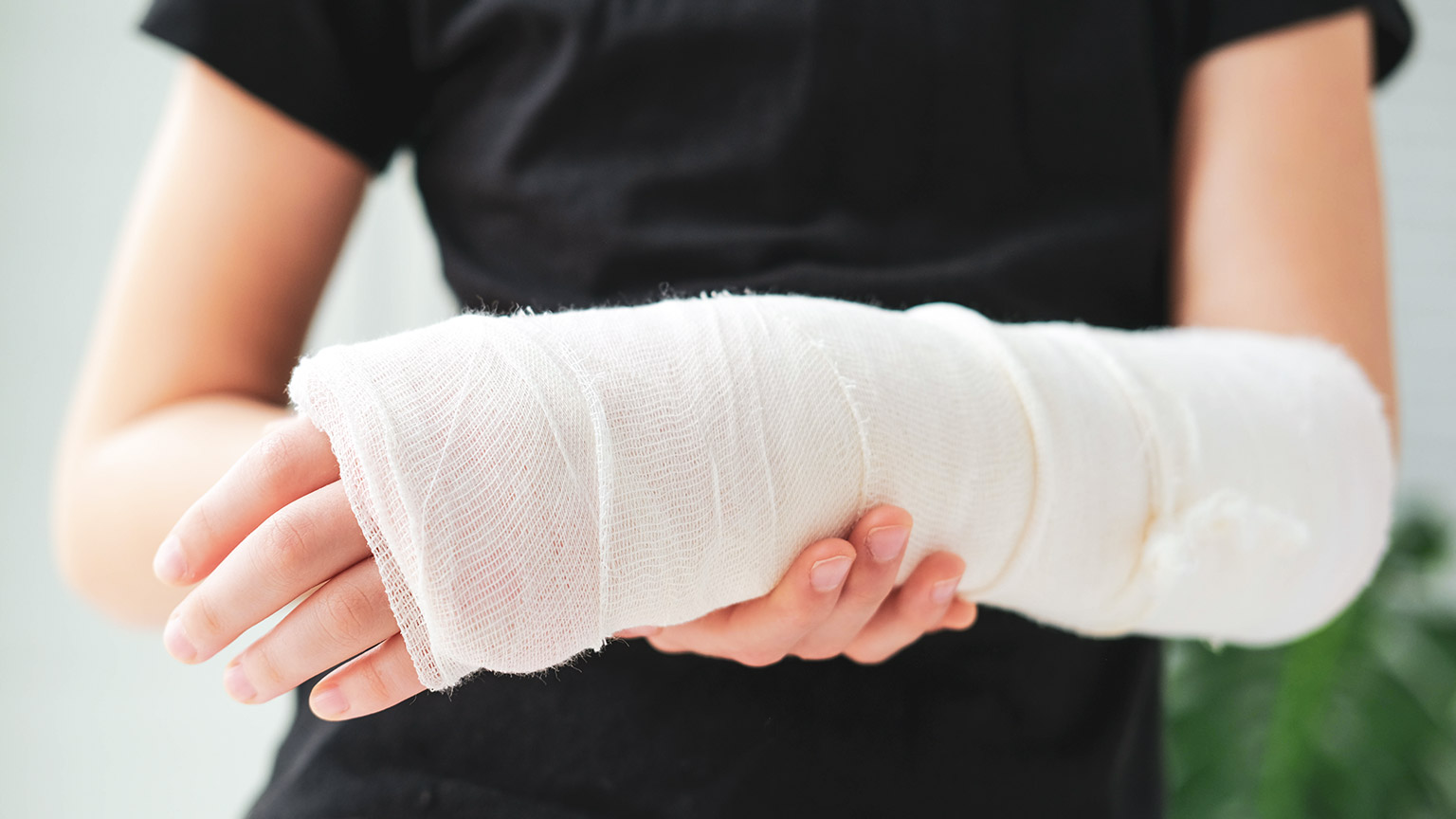 A person holds their broken arm in a cast.