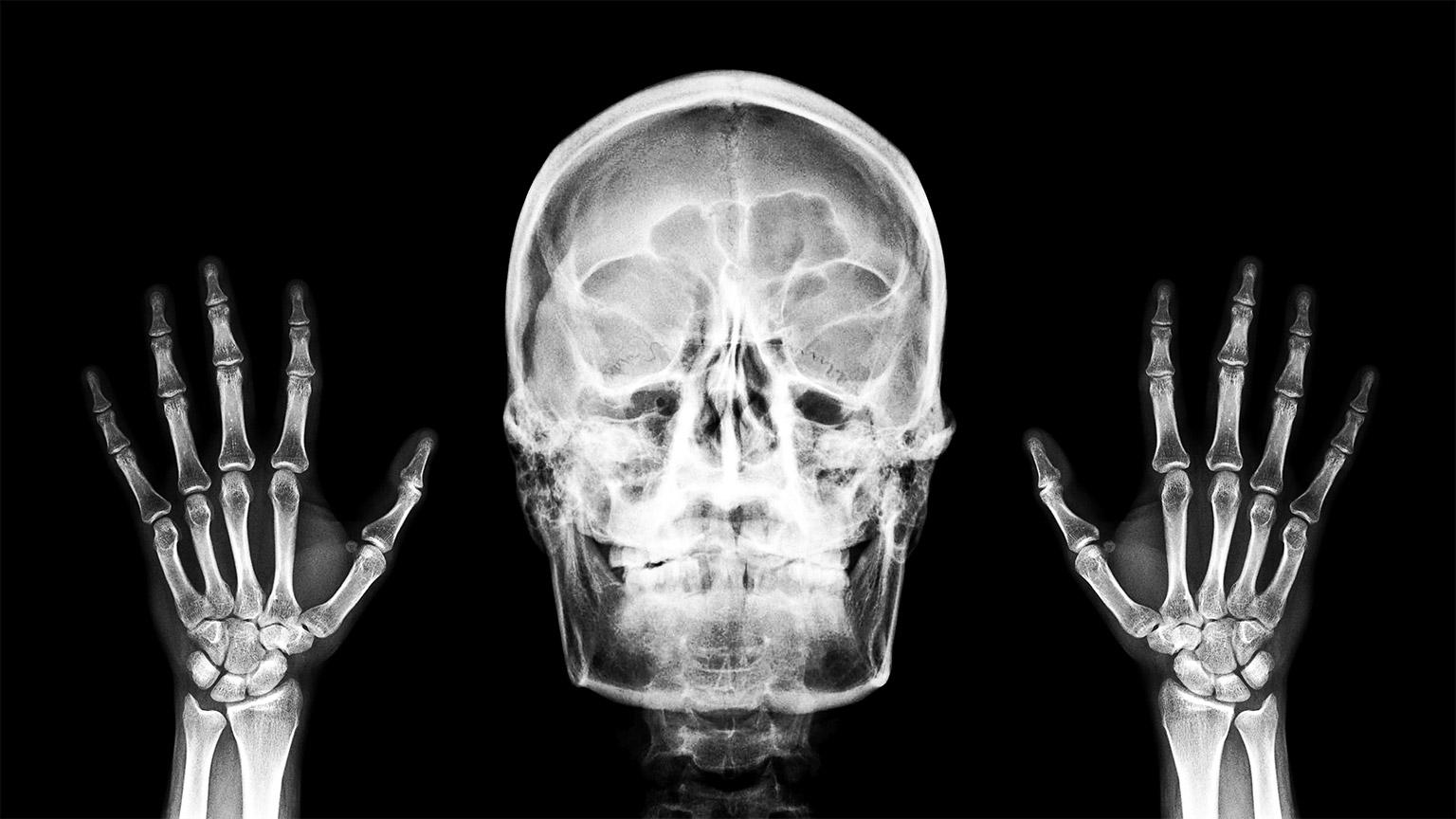  ray radiograph show human anatomy of skull bone and skeleton 