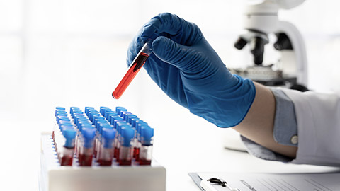 a lab tech testing vials from a centrifuge