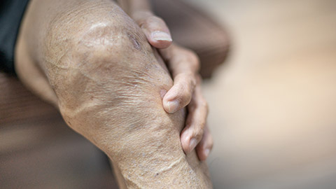 A close view of a person holding their knee