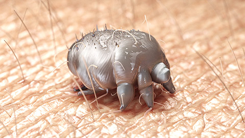 3d rendered medically accurate illustration of a scabies mite on human skin