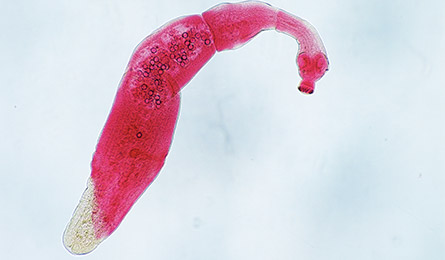 Hydatid worm