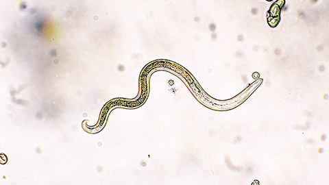 a microscopice image of a roundworm