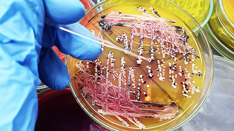 a petri dish of a salmonella culture