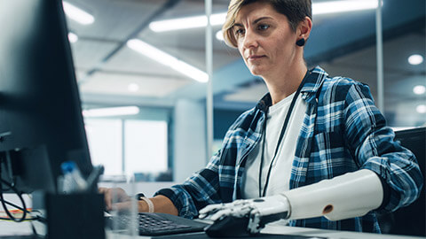 A person with a prosthetic arm using a computer