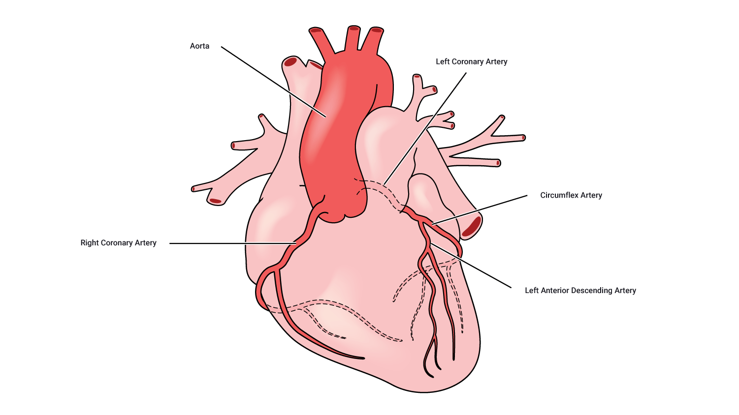 Image of main blood supply to the heart